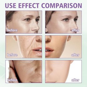 Diluer fine ride Lifting Cream,Creme Liftante Instantanée,Resserrer la peau et Réduire Ride et Ridules