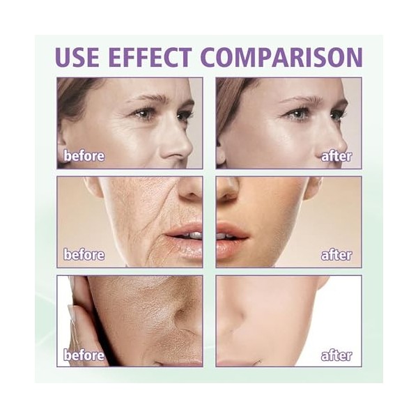 Diluer fine ride Lifting Cream,Creme Liftante Instantanée,Resserrer la peau et Réduire Ride et Ridules