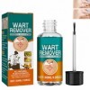 Liquide Délimination Des Verrues,Liquide Anti Verrues,Sérums Délimination Des Acrochordons,Pour Les Types De Peau,30ml