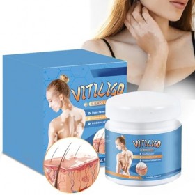 Grgowe Crème pour le traitement du vitiligo - Pommade pour soulager les taches blanches sur la peau