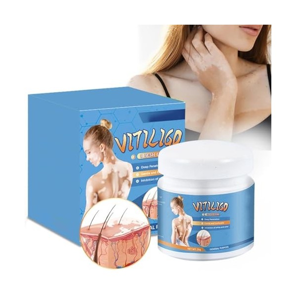 Grgowe Crème pour le traitement du vitiligo - Pommade pour soulager les taches blanches sur la peau