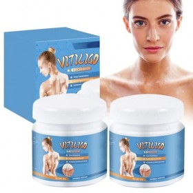 Grgowe Crème pour le traitement du vitiligo - Pommade pour soulager les taches blanches sur la peau