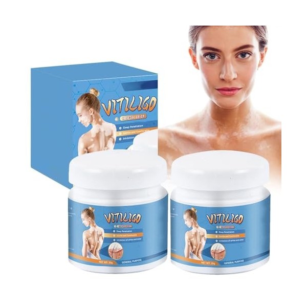 Grgowe Crème pour le traitement du vitiligo - Pommade pour soulager les taches blanches sur la peau