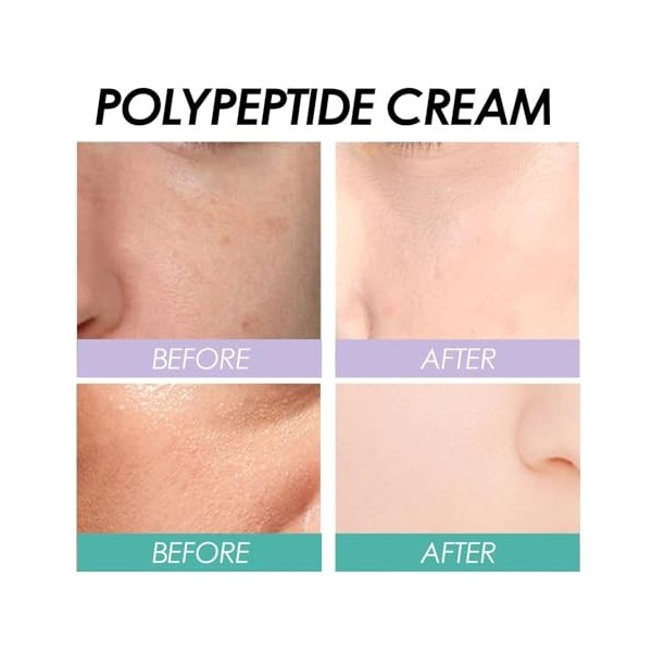 Polypeptide Cream for Facial, Crème Hydratante Antioxydante pour le Visage, Pompe à Bulles Push Down Crème Hydratante pour le