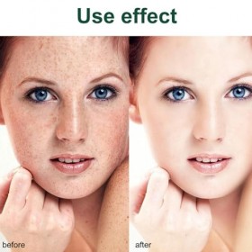 Creme Visage Anti Taches,Moisturizing Firming Cream,Anti Taches Crème,Crème Blanchissante,Hydrate et Nourrit,Illumine le Tein