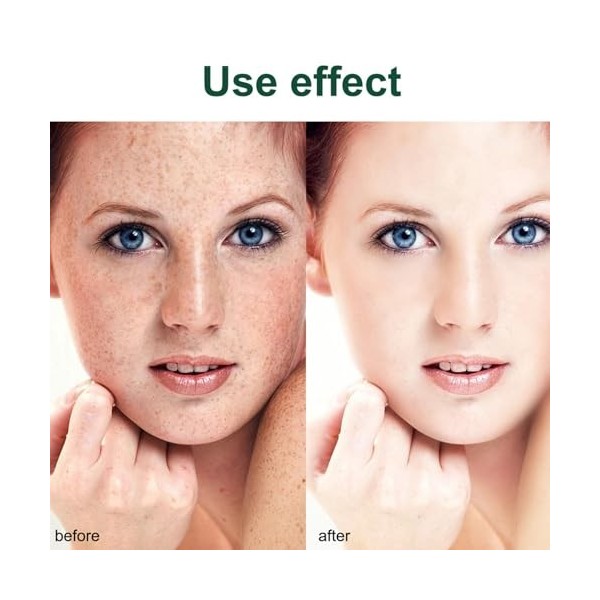 Creme Visage Anti Taches,Moisturizing Firming Cream,Anti Taches Crème,Crème Blanchissante,Hydrate et Nourrit,Illumine le Tein