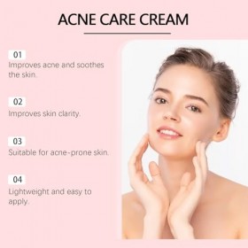 Creme Acne Visage, Crème Anti Acné, Crème Anti Boutons Visage, Creme Anti Imperfection, pour Peau à Tendance Acnéique, convie
