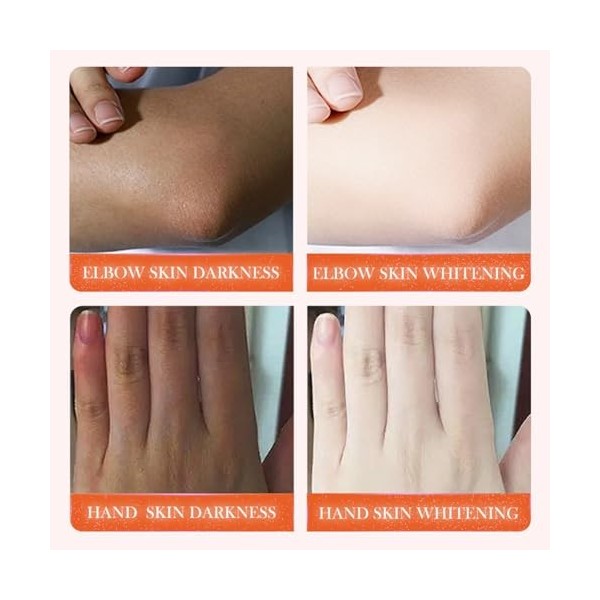 Dark Knuckle Sérum éclaircissant pour la peau, 50 ml, sérum blanchissant, crème blanchissante, répare la mélanine, améliore l