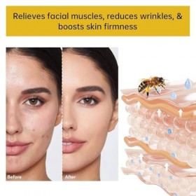 Lot de 2 crèmes professionnelles au venin dabeille - 50 g - Crème régénérante pour la peau - Ingrédients naturels - Pour tou