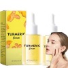 Curcuma Sérum éclaircissant pour la peau au curcuma Dark Spot Correcting Glow Sérum, réduction des rides et ridules, hydratat...