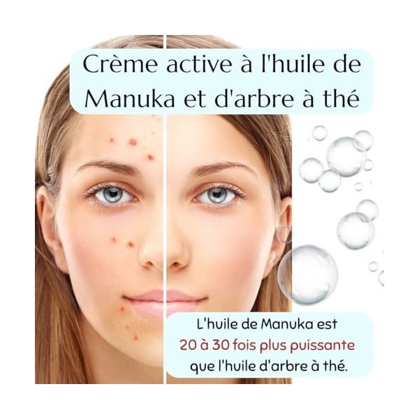 Green idea - Manuka Crème anti-acné – Crème Anti-Imperfections - Anti Boutons – Crème pour le visage à lhuile darbre à thé 
