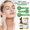 Huile de Vitamine E Bio 75 000 UI + Outil de Massage Gua Sha Visage à lAction Antioxydante, Hydratant,Réducteur de Cicatrice