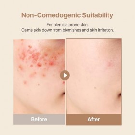 PURITO Oat In Calming Gel Cream, Oat Seed Water, Lightweight Non-Sticky Moisturizer, Non-Comedogenic, Fragrance-Free, Korean ...