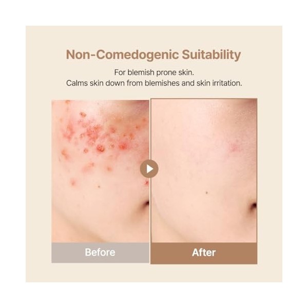 PURITO Oat In Calming Gel Cream, Oat Seed Water, Lightweight Non-Sticky Moisturizer, Non-Comedogenic, Fragrance-Free, Korean ...