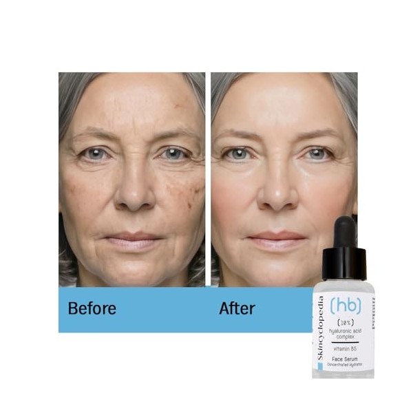 Skincyclopedia Sérum hyaluronique B5 hautement dosé, sérum anti-âge pour le visage à lacide hyaluronique, soin du visage ave