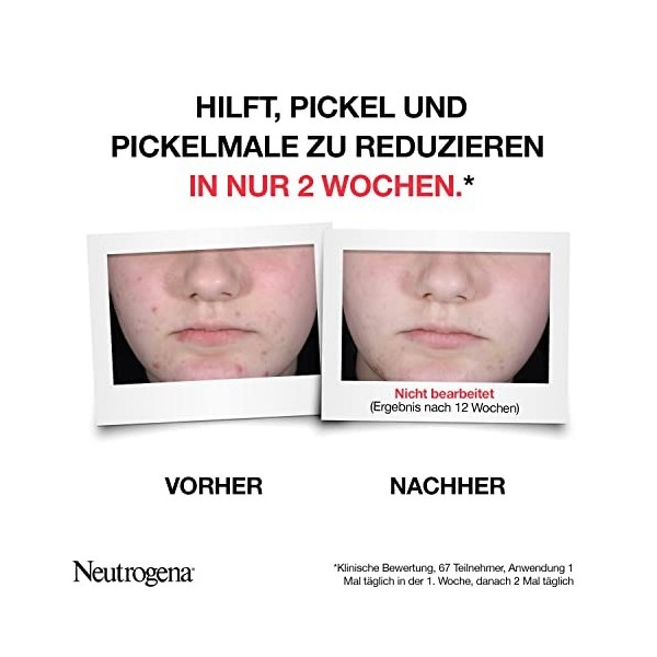 Neutrogena | Sérum Visage Quotidien Anti-Boutons+ tube de 30 ml – Soin visage à lacide salicylique + 10% AHA/PHA – Sérum a Cr...