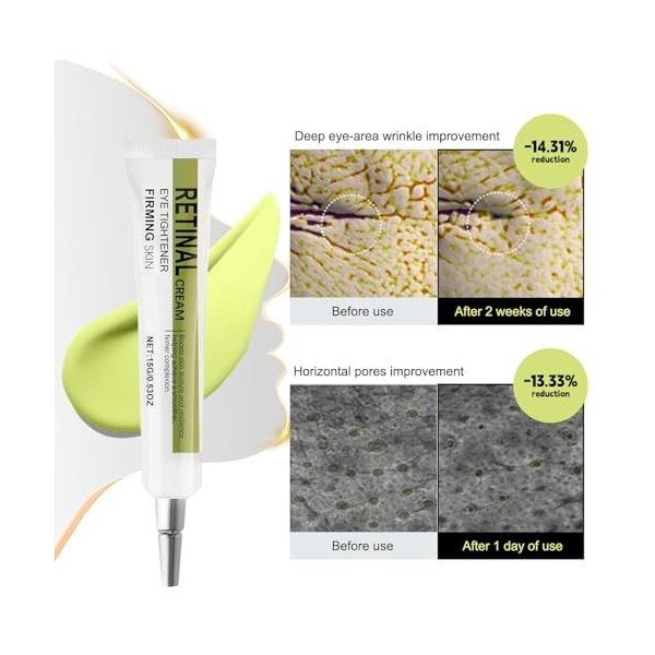 Vibbang Retinal Shot Tightening Booster, Retinol Serum Visage, Retinal Mild Facial Care Fluid, Rétinol Firming Sérum, Anti-âg...