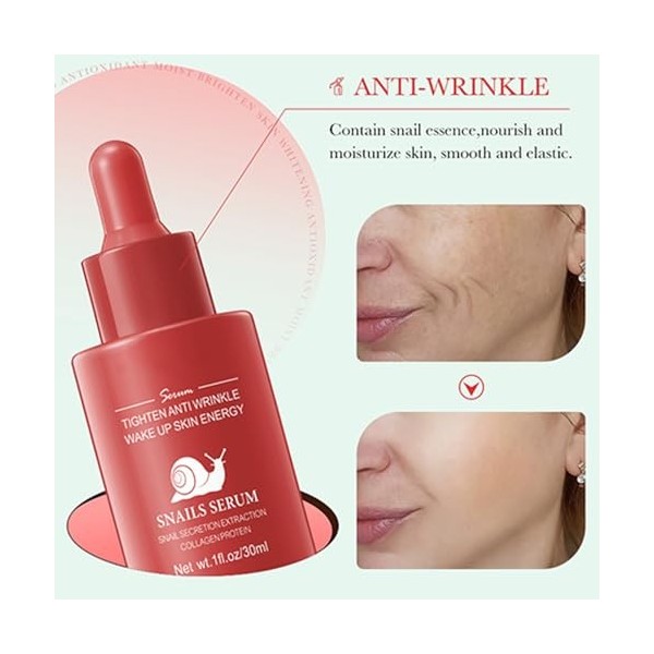 Turmeric Sérum + Sérum à la niacinamide + Sérum à la bave descargot Sérum pour le visage Skin Care Kit de sérum réparateur d