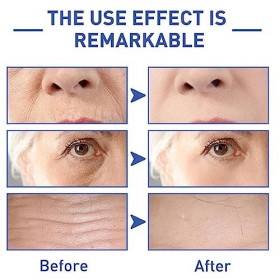 Eel Essence Series Essence hydratante à languille Essence de soins de la peau à languille Essence hydratante éclaircissante C...