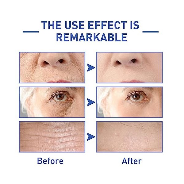 Eel Essence Series Essence hydratante à languille Essence de soins de la peau à languille Essence hydratante éclaircissante C...