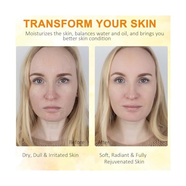 Beef Tallow Skin Care 120 g, Tallow and Honey Balm for Face & Body-100% Grass-Fed Beef Tallow, Deep Hydration & Nourish Whipp