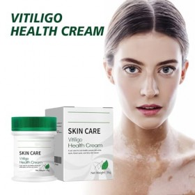 Crème Soin Vitiligo - Formule Végétale Naturelle, Unifie le Teint, Améliore le Grain de Peau, Convient aux Peaux Sensibles, 3