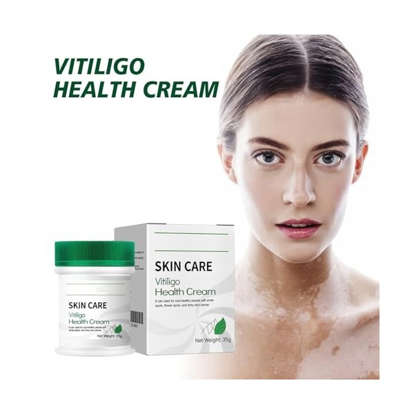 Crème Soin Vitiligo - Formule Végétale Naturelle, Unifie le Teint, Améliore le Grain de Peau, Convient aux Peaux Sensibles, 3
