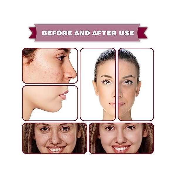 Essence de traitement de lérythème Skinrevive Essence de traitement de lérythème de beauté Essence de rajeunissement instan C...