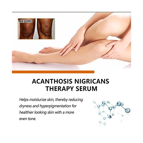 Sérum éclaircissant avancé pour éliminer la mélanose et les taches brunes Blackthorn Repair Essence Essence éclaircissante av...