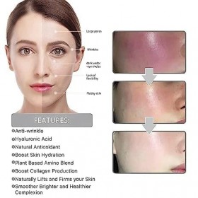 Correcteur de taches brunes Flexehag Sérum pour le visage correcteur de mélanine Sérum pour le visage quotidien pour la répar...