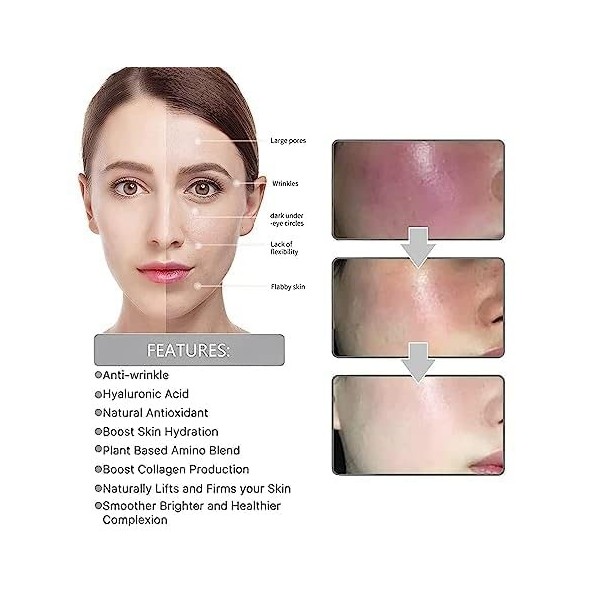 Correcteur de taches brunes Flexehag Sérum pour le visage correcteur de mélanine Sérum pour le visage quotidien pour la répar...