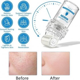 Flysmus Pockmarksheal Microdart Roller à lacide hyaluronique, sérum à lacide hyaluronique, améliore les rides et les ridule C...