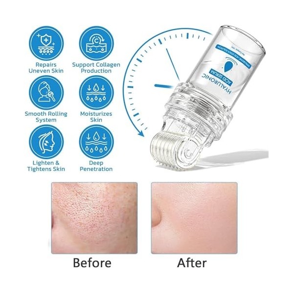 Flysmus Pockmarksheal Microdart Roller à lacide hyaluronique, sérum à lacide hyaluronique, améliore les rides et les ridule C...