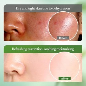 Eazerom 24 50g de Gel dAloe Vera,pour le Visage,le Corps,les Cheveux,les Coups de Soleil,Après-Soleil,Cicatrices,Apaisant & 