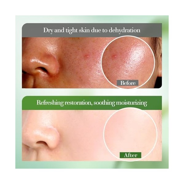 Eazerom 24 50g de Gel dAloe Vera,pour le Visage,le Corps,les Cheveux,les Coups de Soleil,Après-Soleil,Cicatrices,Apaisant & 