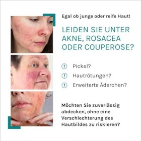 Benevi Color Pigmentcreme hell, 20 ml Crème