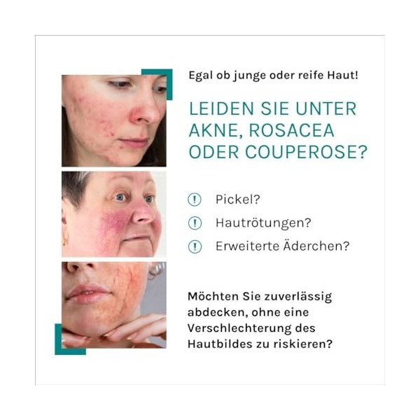 Benevi Color Pigmentcreme hell, 20 ml Crème