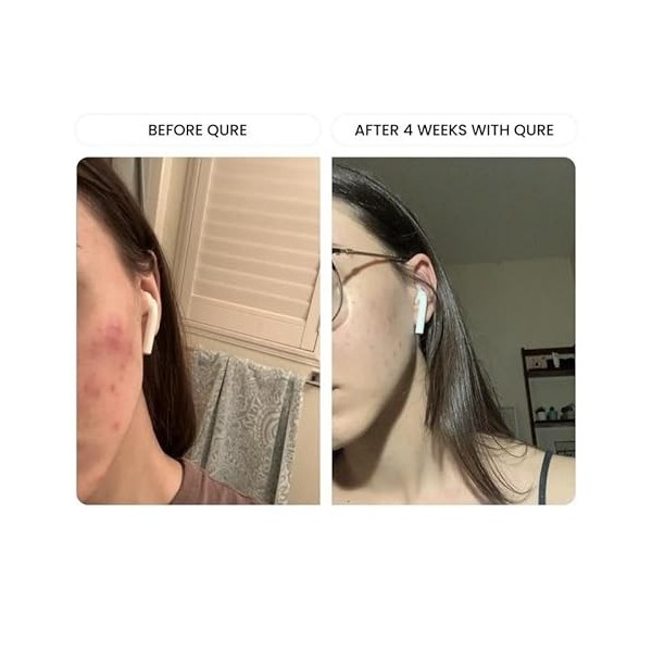 Sérum Visage Multi-Effets, 30 ml - Des résultats visibles : une peau lisse, ferme et éclatante, les ridules sont estompées. S