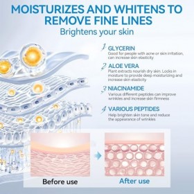 Micro Infusion Visage, Micro Needling Visage, BB Facial Glow, Raffermit la Peau et Illumine le Teint, 10 * 5ml