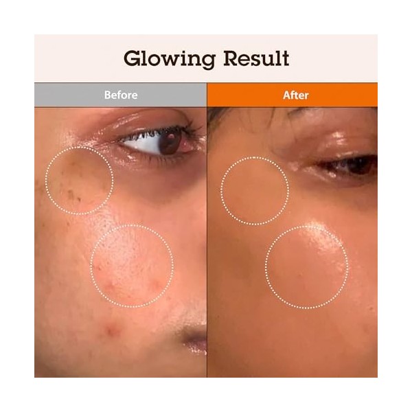 BLITHE Targeted Blemish Serum Niacinamide 5.0 – Sérum anti-taches avec 5 % niacinamide, 3 % acide tranexamique, arbutine, vit