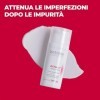 Acne Out Crème réparatrice SPF 30 30 ml spécialement conçue pour les cicatrices acnées Réduit les taches rouges sur la peau P