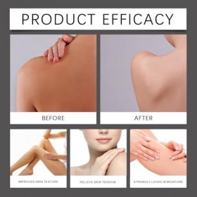 Crème à lurée anti-taches, crème éclaircissante pour les taches brunes, hydratante et blanchissante, anti-taches de rousseur ...