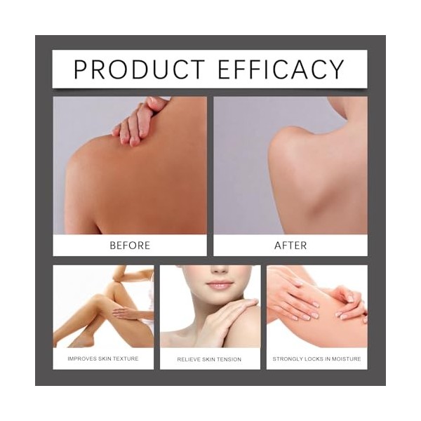 Crème à lurée anti-taches, crème éclaircissante pour les taches brunes, hydratante et blanchissante, anti-taches de rousseur ...