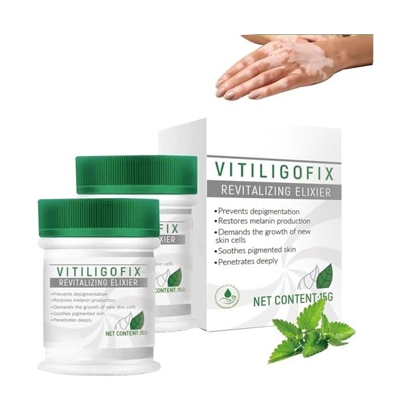 Crème de recoloration pour le traitement du vitiligo,essence revitalisante réparatrice du vitiligo,hydratant pour éliminer le