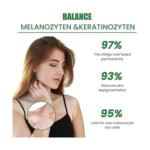 Crème de recoloration pour le traitement du vitiligo,essence revitalisante réparatrice du vitiligo,hydratant pour éliminer le