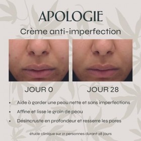 Apologie Crème Hydratante CBD Anti-imperfections, Anti-marques et Purifiante - Pour le Visage - 50 ml Format Voyage - Efficac