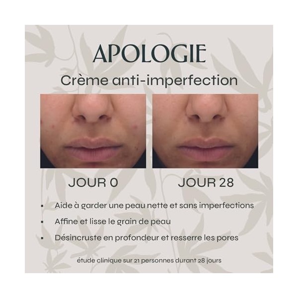 Apologie Crème Hydratante CBD Anti-imperfections, Anti-marques et Purifiante - Pour le Visage - 50 ml Format Voyage - Efficac