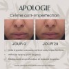 Apologie Crème Hydratante CBD Anti-imperfections, Anti-marques et Purifiante - Pour le Visage - 50 ml Format Voyage - Efficac