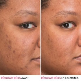 It Cosmetics Bye Bye Dark Spots sérum taches Niacinamide 30ml