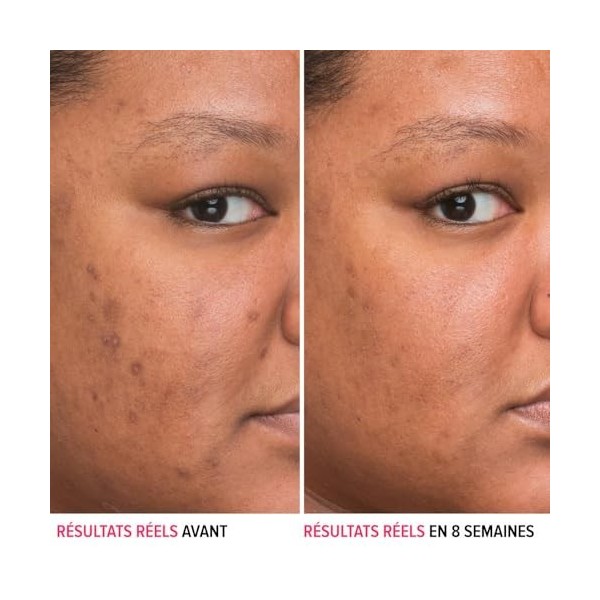 It Cosmetics Bye Bye Dark Spots sérum taches Niacinamide 30ml